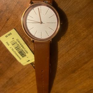 Woman’s skagen watch